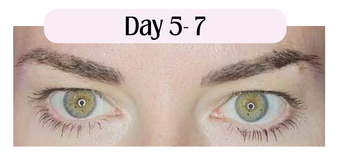 Image of permanent makeup tattoo service microbladed eyebrows showing what to expect during the healing process on day 5.  Eyebrow microblading after 1-30 days of the healing process day to day.